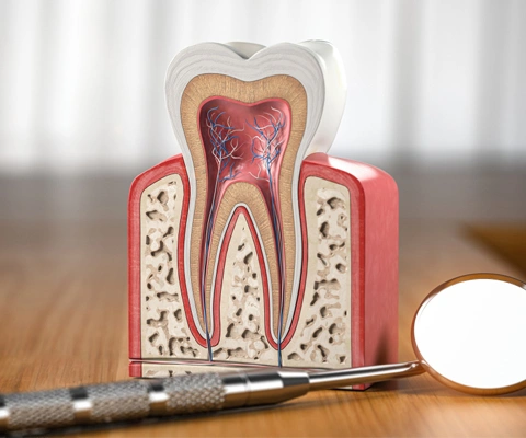 img-root-canal-lp